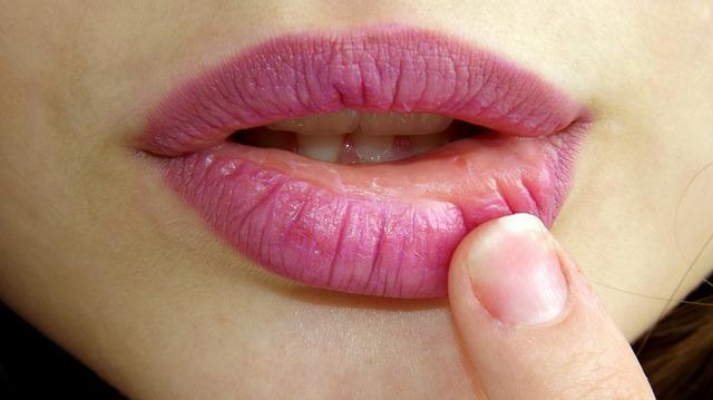 Botox Lip Flip Procedure is done in conjunction with other Botox for your face.